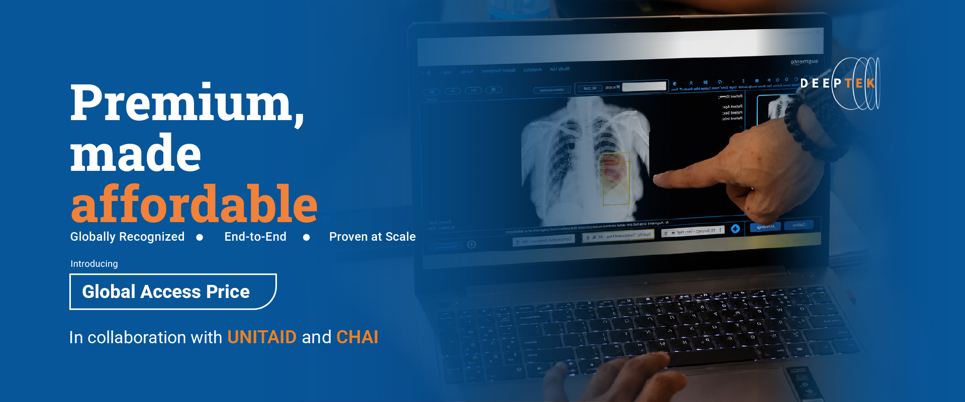 DeepTek Launches Global Access Pricing to Make AI-Powered TB Screening More Affordable